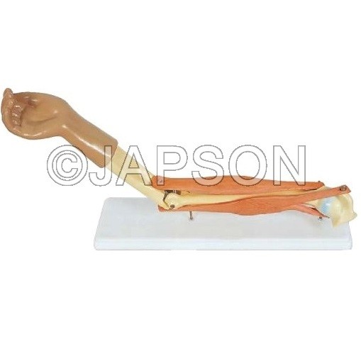 Human Elbow Joint Model, Functional