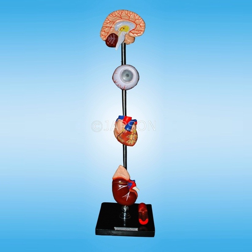 Human Hypertension Model, 6 Parts