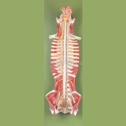 Spinal cord in the spinal canal