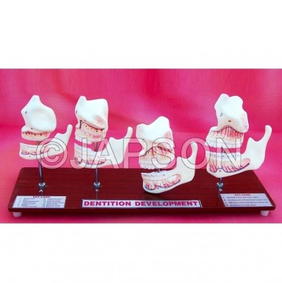 Human Teeth Model, Dentition Development on Stand