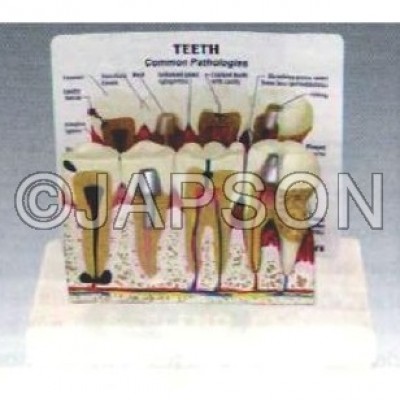 Teeth Model With Description Plate